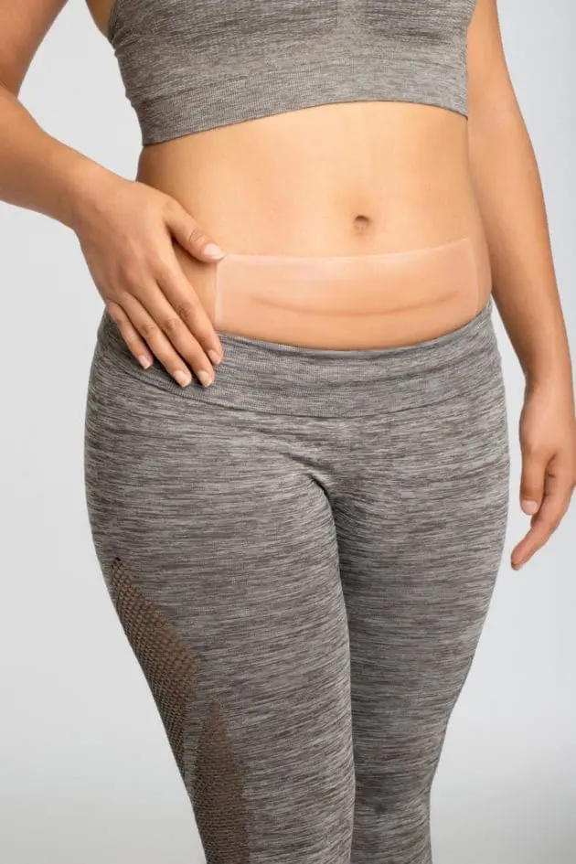 Curascar square patches ideal for abdominal scars